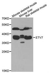 Western blot analysis of extracts of various cell lines, using ETV7 antibody.