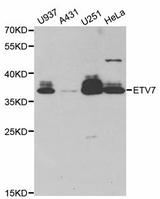 Western blot analysis of extracts of various cell lines, using ETV7 antibody.