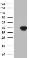 HEK293T cells were transfected with the pCMV6-ENTRY control (Left lane) or pCMV6-ENTRY ETV7 (Right lane) cDNA for 48 hrs and lysed. Equivalent amounts of cell lysates (5 ug per lane) were separated by SDS-PAGE and immunoblotted with anti-ETV7.