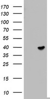 HEK293T cells were transfected with the pCMV6-ENTRY control (Left lane) or pCMV6-ENTRY ETV7 (Right lane) cDNA for 48 hrs and lysed. Equivalent amounts of cell lysates (5 ug per lane) were separated by SDS-PAGE and immunoblotted with anti-ETV7.