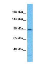 Western blot of Human HepG2. TELO2 antibody dilution 1.0 ug/ml.