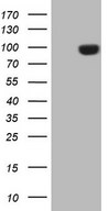 HEK293T cells were transfected with the pCMV6-ENTRY control (Left lane) or pCMV6-ENTRY CD248 (Right lane) cDNA for 48 hrs and lysed. Equivalent amounts of cell lysates (5 ug per lane) were separated by SDS-PAGE and immunoblotted with anti-CD248.