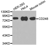 Western blot analysis of extracts of various cell lines, using CD248 antibody.