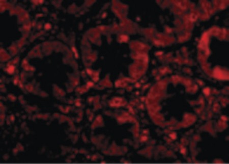 Immunofluorescence of TEM1 in Human Colon cells with TEM1 antibody at 20 ug/ml.