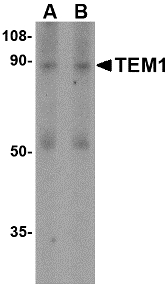 Western blot of TEM1 in human colon tissue lysate with TEM1 antibody at (A) 0.5 and (B) 1 ug/ml. Below: Immunohistochemistry of TEM1 in human colon tissue with TEM1 antibody at 2.5 ug/ml.