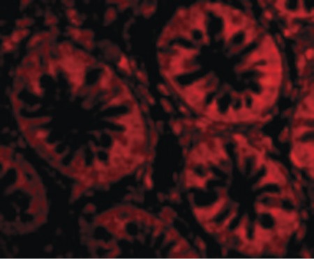 Immunofluorescence of TEM1 in Human Colon cells with TEM1 antibody at 20 ug/ml.