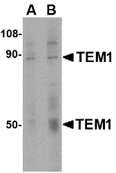 Western blot of TEM1 in human colon tissue lysate with TEM1 antibody at (A) 0.5 and (B) 1 ug/ml. Below: Immunohistochemistry of TEM1 in human colon tissue with TEM1 antibody at 2.5 ug/ml.