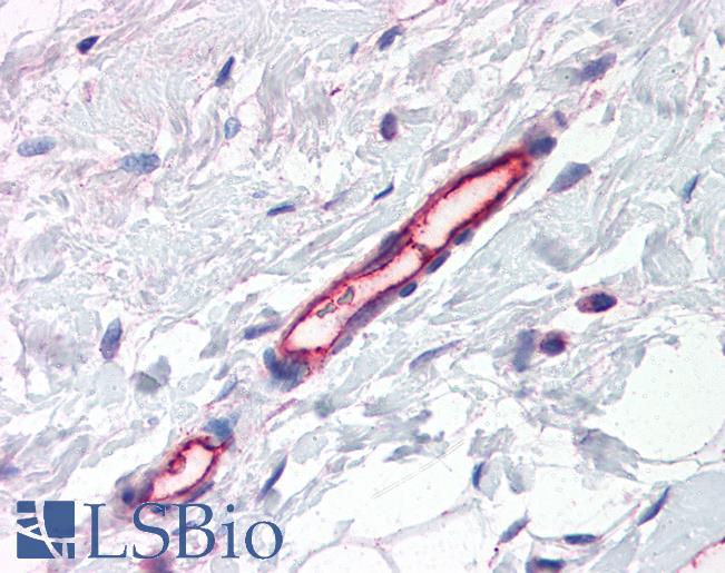 Anti-TEM7 antibody IHC of human breast, vessels. Immunohistochemistry of formalin-fixed, paraffin-embedded tissue after heat-induced antigen retrieval. Antibody LS-B2674 concentration 5 ug/ml.