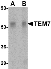 Western blot of TEM7 in rat liver tissue lysate with TEM7 antibody at (A) 0.5 and (B) 1 ug/ml.