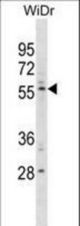 PLXDC1 Antibody western blot of WiDr cell line lysates (35 ug/lane). The PLXDC1 antibody detected the PLXDC1 protein (arrow).