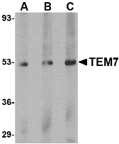 Western blot of TEM7 in human liver tissue lysate with TEM7 antibody at (A) 0.5, (B) 1 and (C) 2 ug/ml.