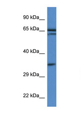 TERF2IP antibody LS-B5895 Western blot of Mouse Pancreas lysate. Antibody concentration 1 ug/ml.