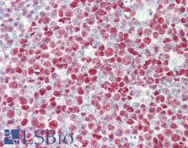 Anti-TERF2IP / RAP1 antibody IHC staining of human tonsil. Immunohistochemistry of formalin-fixed, paraffin-embedded tissue after heat-induced antigen retrieval. Antibody LS-B11292 concentration 5 ug/ml.