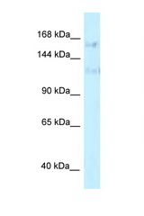 PRPF40A antibody LS-C145781 Western blot of HepG2 Cell lysate. Antibody concentration 1 ug/ml.