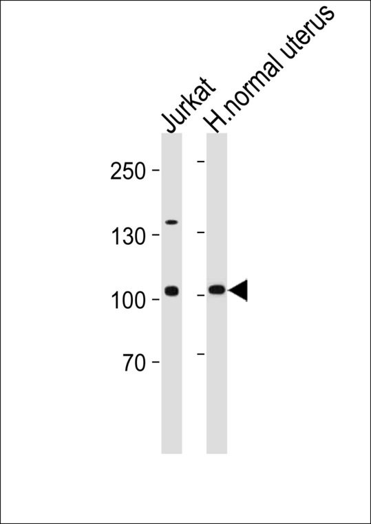 TERT Antibody (pS1125) western blot of Jurkat cell line and human normal uterus tissue lysates (35 ug/lane). The TERT antibody detected the TERT protein (arrow).