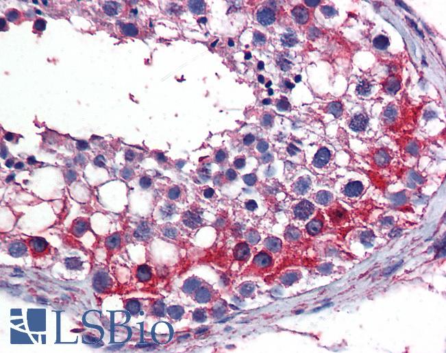 Anti-TES / Testin antibody IHC of human testis. Immunohistochemistry of formalin-fixed, paraffin-embedded tissue after heat-induced antigen retrieval. Antibody LS-B6222 concentration 3 ug/ml.