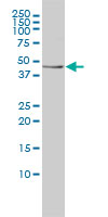 Antibody LS-B6222, Western blot of TES expression in K-562.