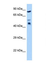 TES / Testin antibody LS-C146127 Western blot of HeLa Cell lysate. Antibody concentration 1 ug/ml.