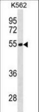 TES Antibody western blot of K562 cell line lysates (35 ug/lane). The TES antibody detected the TES protein (arrow).