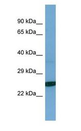 TESC antibody Western Blot of Jurkat. Antibody dilution: 1 ug/ml.