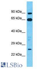 TESC antibody Western Blot of HT1080. Antibody dilution: 1 ug/ml.