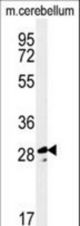 Western blot of TESC Antibody in mouse cerebellum tissue lysates (35 ug/lane). TESC (arrow) was detected using the purified antibody.