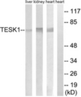 Western blot of extracts from rat heart/rat kidney/rat liver cells, using TESK1 Antibody. The lane on the right is treated with the synthesized peptide.