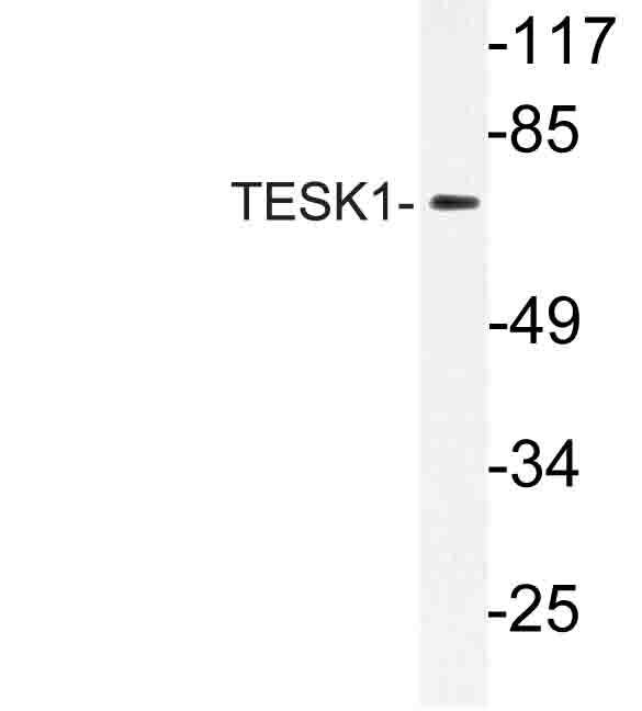 Western blot of TESK1 (V217) pAb in extracts from rat liver cells.