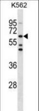 TESK1 Antibody western blot of K562 cell line lysates (35 ug/lane). The TESK1 antibody detected the TESK1 protein (arrow).