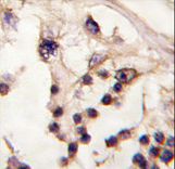 Formalin-fixed and paraffin-embedded human testis tissue reacted with TESK2 antibody , which was peroxidase-conjugated to the secondary antibody, followed by DAB staining. This data demonstrates the use of this antibody for immunohistochemistry; clinical relevance has not been evaluated.