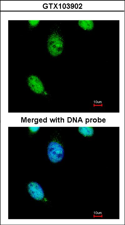 Immunofluorescence of paraformaldehyde-fixed HeLa using TESK2 antibody at 1:200 dilution.
