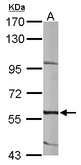Sample (50 ug of whole cell lysate). A: mouse liver. 7.5% SDS PAGE. TESK2 antibody diluted at 1:1000.