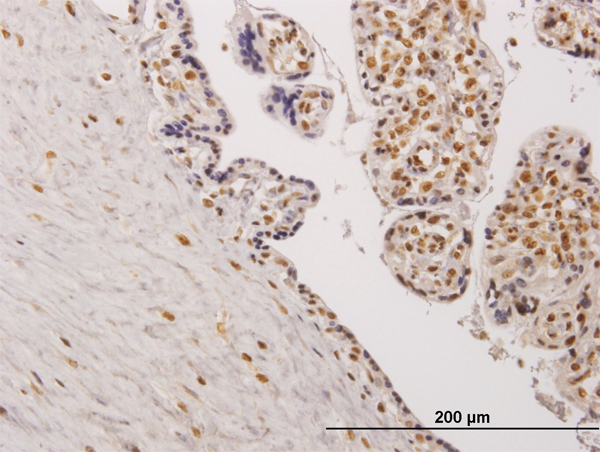 Immunoperoxidase of monoclonal antibody to TESK2 on formalin-fixed paraffin-embedded human placenta. [antibody concentration 0.5 ug/ml]