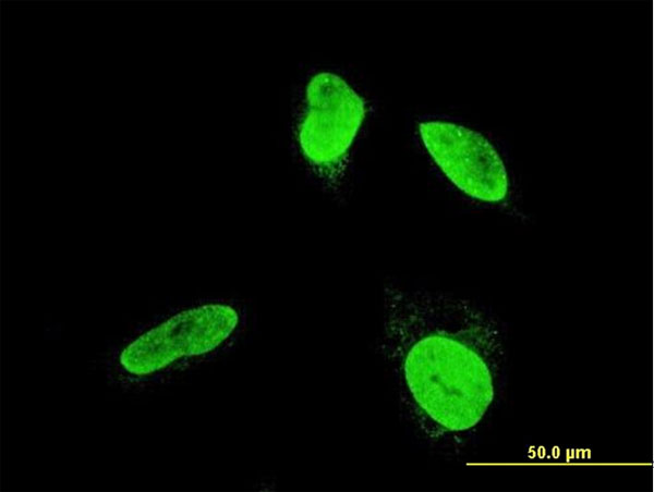 Immunofluorescence of monoclonal antibody to TESK2 on HeLa cell. [antibody concentration 10 ug/ml].