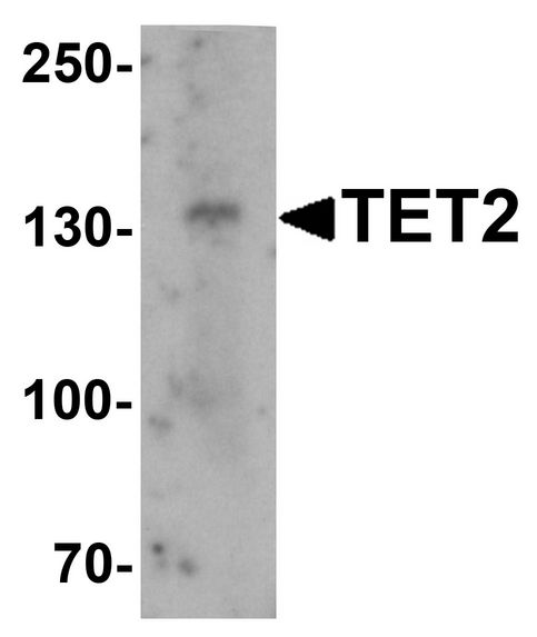 Western blot analysis of TET2 in SK-N-SH cell lysate with TET2 antibody at 1 ug/ml.
