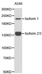 Western blot analysis of extracts of A549 cell line, using TET2 antibody.