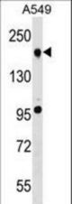 TET2 Antibody western blot of A549 cell line lysates (35 ug/lane). The TET2 antibody detected the TET2 protein (arrow).