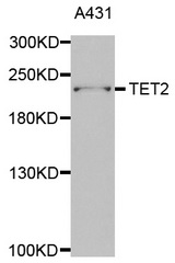 Western blot analysis of extracts of A431 cell line, using TET2 antibody.