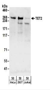 Detection of Human TET2 by Western Blot. Samples: Whole cell lysate (50 ug) from HeLa, 293T, and Jurkat cells. Antibodies: Affinity purified rabbit anti-TET2 antibody used for WB at 0.1 ug/ml. Detection: Chemiluminescence with an exposure time of 30 seconds.