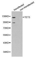Western blot analysis of extracts of 293T cell lines, using TET3 antibody.