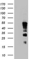 HEK293T cells were transfected with the pCMV6-ENTRY control (Left lane) or pCMV6-ENTRY TET3 (Right lane) cDNA for 48 hrs and lysed. Equivalent amounts of cell lysates (5 ug per lane) were separated by SDS-PAGE and immunoblotted with anti-TET3.
