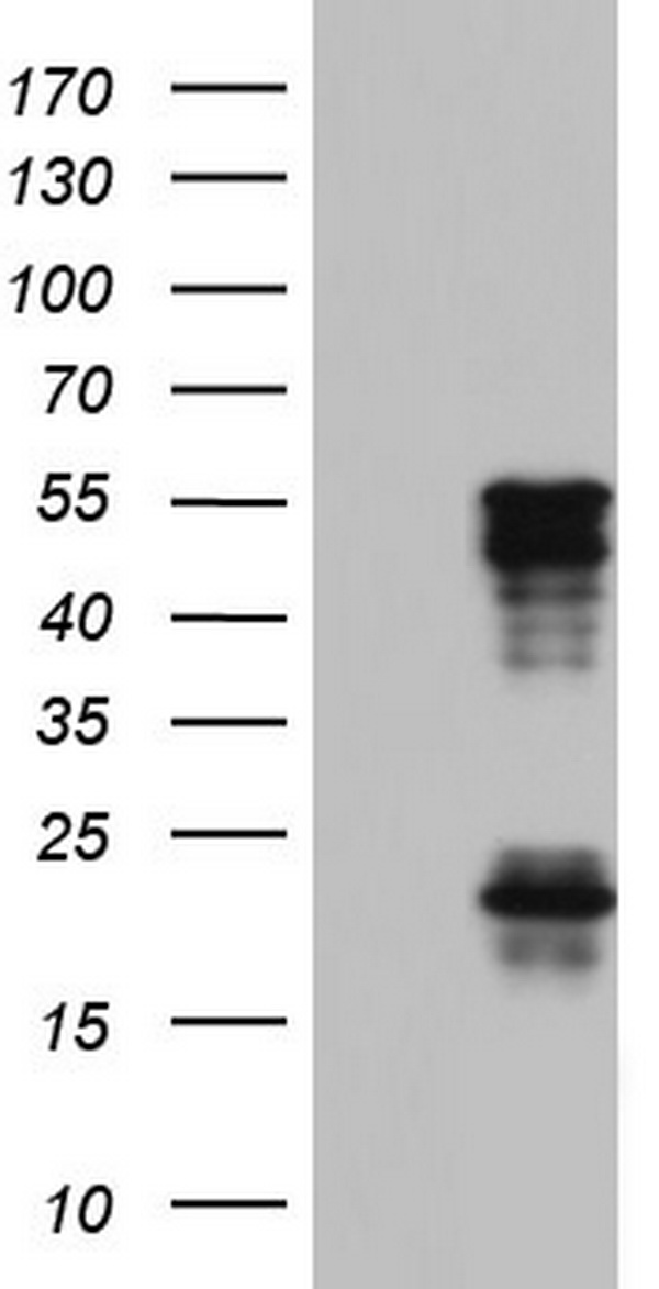 HEK293T cells were transfected with the pCMV6-ENTRY control (Left lane) or pCMV6-ENTRY TET3 (Right lane) cDNA for 48 hrs and lysed. Equivalent amounts of cell lysates (5 ug per lane) were separated by SDS-PAGE and immunoblotted with anti-TET3.