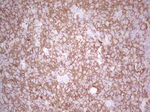 IHC of paraffin-embedded Human tonsil using anti-TET3 mouse monoclonal antibody. (Heat-induced epitope retrieval by 1 mM EDTA in 10mM Tris, pH8.5, 120°C for 3min).