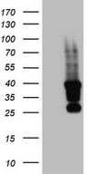 HEK293T cells were transfected with the pCMV6-ENTRY control (Left lane) or pCMV6-ENTRY TET3 (Right lane) cDNA for 48 hrs and lysed. Equivalent amounts of cell lysates (5 ug per lane) were separated by SDS-PAGE and immunoblotted with anti-TET3.