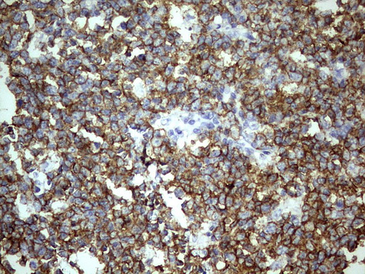 IHC of paraffin-embedded Human tonsil using anti-TET3 mouse monoclonal antibody. (Heat-induced epitope retrieval by 1 mM EDTA in 10mM Tris, pH8.5, 120°C for 3min).