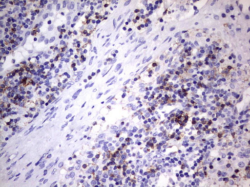 IHC of paraffin-embedded Human lymph node tissue using anti-TET3 mouse monoclonal antibody. (Heat-induced epitope retrieval by 1 mM EDTA in 10mM Tris, pH8.5, 120°C for 3min).