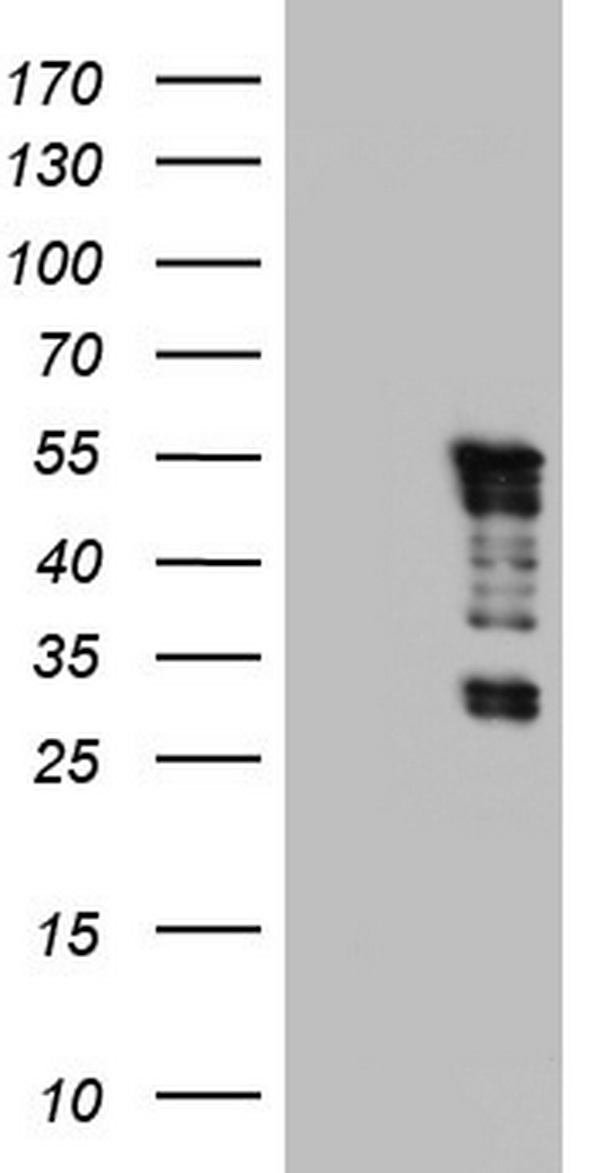 HEK293T cells were transfected with the pCMV6-ENTRY control (Left lane) or pCMV6-ENTRY TET3 (Right lane) cDNA for 48 hrs and lysed. Equivalent amounts of cell lysates (5 ug per lane) were separated by SDS-PAGE and immunoblotted with anti-TET3.