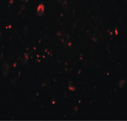 Immunofluorescence of TET3 in human brain tissue with TET3 antibody at 20 ug/ml.