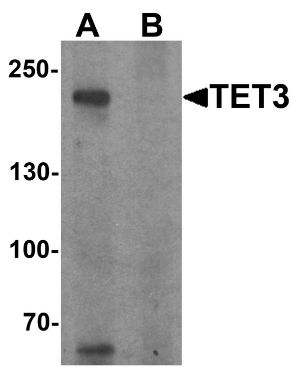 Western blot analysis of TET3 in SK-N-SH cell lysate with TET3 antibody at 1 ug/ml in (A) the absence and (B) the presence of blocking peptide.