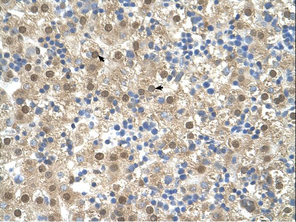 MFSD10 / TETRAN antibody LS-C80690 was used in IHC to stain formalin-fixed, paraffin-embedded human liver.